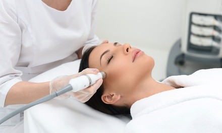 Up to 67% Off on Microdermabrasion at New Glamour Day Spa