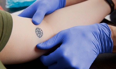 Three PiQo4 Laser Tattoo-Removal Sessions on an Area up to One or Three Square Inches at MS Slim (Up to 82% Off)