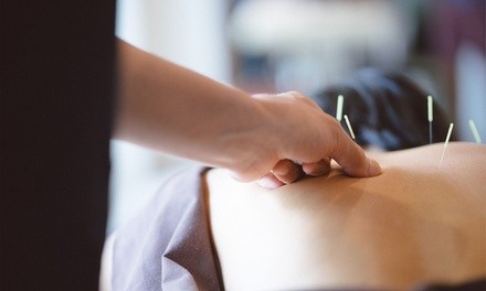 1 or 2 Acupuncture Treatments w/ Exam from Michael Tramontana, D.C., P.A. (Up to 69% Off). 3 Options Available.