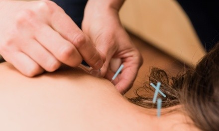 Initial Consultation and One or Three Acupuncture Treatments at Wild Blue Sports Acupuncture (Up to 35% Off)