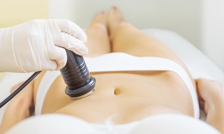 Up to 62% Off Radio Frequency Cavitation Sessions on a Large Area at Upper Cut Salon & Spa 