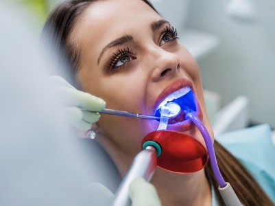 Up to 70% Off on Teeth Whitening - In-Office - Branded (Zoom, Brite Smile) at MH Dental NY PLLC