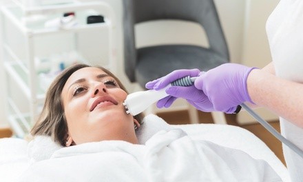 One or Two TempSure Evi Non-Surgical Facelift at Centra Internal Medicine (Up to 65% Off)