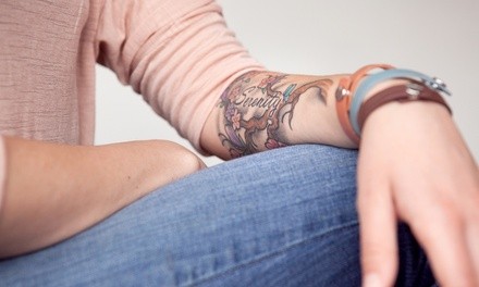 Laser Tattoo-Removal Treatment for a 1