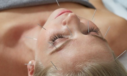 One or Two Facial Acupuncture Sessions with Facial Massage at Welcome Back Health Earnestly (Up to 60% Off)