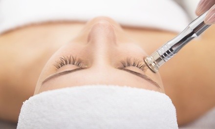 One or Two Diamond Microdermabrasions w/ Peels at The Wellness and Aesthetics Care Center (Up to 60% Off)
