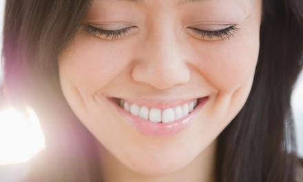 $82 for 45-Minute Dermaplaning Session at Elite Choice Skin ($125 Value)