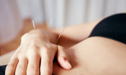 One or Three Acupuncture Sessions at Common Roots Acupuncture (Up to 72% Off) 