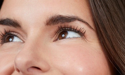 20 or 40 Units of Botox at VIOR Life & Aesthetics (Up to 47% Off)