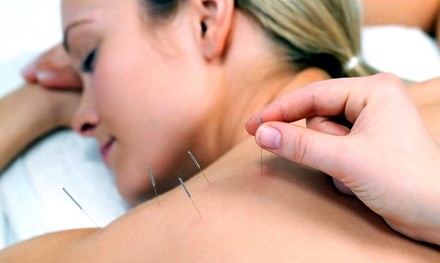 Up to 60% Off on Acupuncture Services at Elite Edge Healthcare