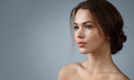 One or Three Diamond Microdermabrasion Treatments at Ritz Med Spa (Up to 67% Off)