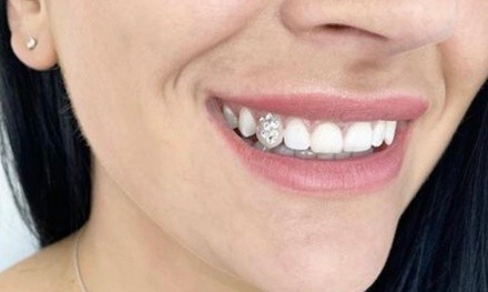 40 or 60 Minute Teeth-Whitening Treatment with Tooth Gem at The Whitening Clinic (Up to 63%Off). 