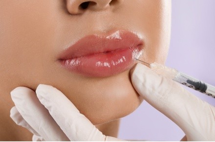 Up to 64% Off on Spider Vein Removal - Injection at Posh Derma Med Spa