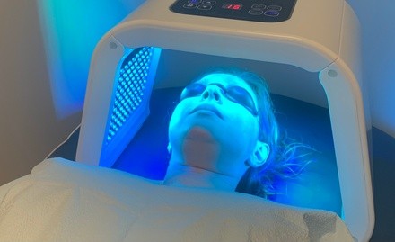 Up to 71% Off on Facial - Peeling at A&M Wellness Internal Medicine Practice and Aesthetics