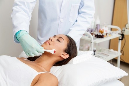 One, Two, or Four ThermaLift Skin-Tightening Facelifts at The Indigo Room (Up to 88% Off)