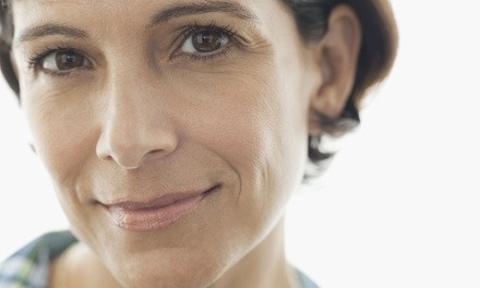 Two or Four PDO Threads for Face or Neck Lift at Vitality Medspa (Up to 41% Off)