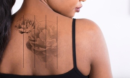 One Laser Tattoo-Removal Session at Chroma Tattoo Studio & Laser Tattoo Removal (Up to 75% Off)