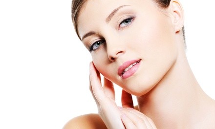 Perfect Derma Peel with Optional Microdermabrasion at Beauty by Vida (Up to 51% Off)