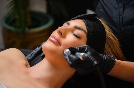 One or Two Microneedling Sessions at The Beauty Hut Face & Body Sculpting (Up to 71% Off)