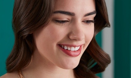 $50 for One In-Office Teeth-Whitening Treatment at Electrik Image Spa ($150 Value)