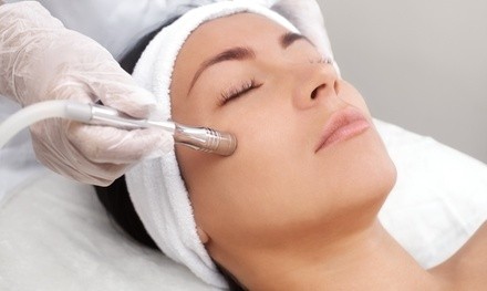 One, Two, or Four Diamond Microdermabrasion Treatments w/ LED Light Therapy at Pink Diamond Spa (Up to 64% Off)