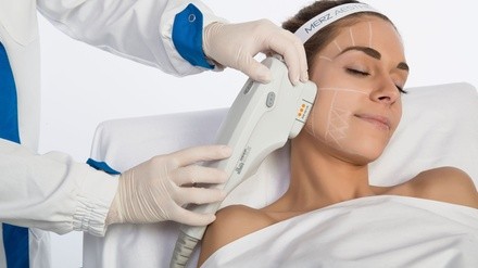 Ultherapy for Brow Lift, Jawline, or Face and Optional Neck at Dermix Medical Aesthetics Group (Up to 80% Off)