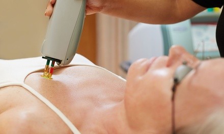 Six IPL Treatments for Face or Body at Med Spa Cordova (Up to 30% Off). 10 Options Available.