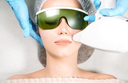 Up to 14% Off on IPL Photo Facial at Cosmetic Laser Advantage