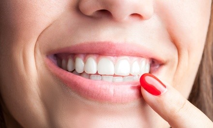 Up to 39% Off on Teeth Whitening - In-Office - Non-Branded at Bora Beauty LLC