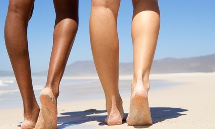 One Laser Spider-Vein Removal Treatment for One or Two Lower Legs at Little W's Spa (Up to 40% Off)