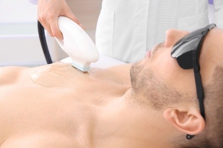 Six Laser Hair-Removal Sessions for a Small, Medium, or Large Area at VE Medspa and Salon (Up to 90% Off)