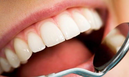 Up to 49% Off on Teeth Whitening - In-Office - Non-Branded at Ethos teeth whitening