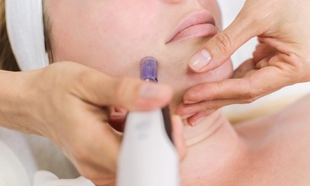 One or Two Microneedling Sessions with LED Therapy at Body Face Image Solutions (Up to 50% Off)