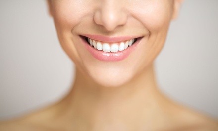 Up to 48% Off on Teeth Whitening - In-Office - Non-Branded at The joy experience