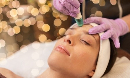 $49 for One Crystal Microdermabrasion Treatment at Valley Aesthetic ($85 Value)