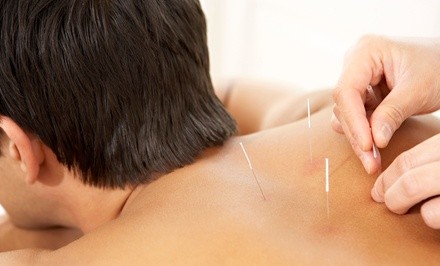 Up to 52% Off on Acupuncture Services at David Lee Acupuncture