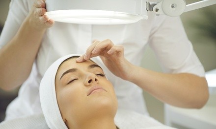 One or Two PCA Chemical Peels at Golla Center for Plastic Surgery (Up to 52% Off)