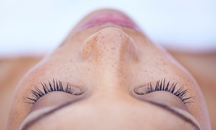 Facial, Microdermabrasion, and Décolleté and Neck Treatment at New Image Aesthetics (Up to 70% Off). 2 Options.