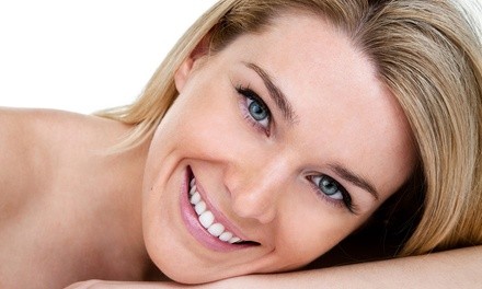 One or Two Diamond Microdermabrasion Facials at The Glamour Salon Spa (Up to 50% Off)