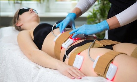 Up to 75% Off on Radio Frequency Skin Tightening at Hour Body Contouring