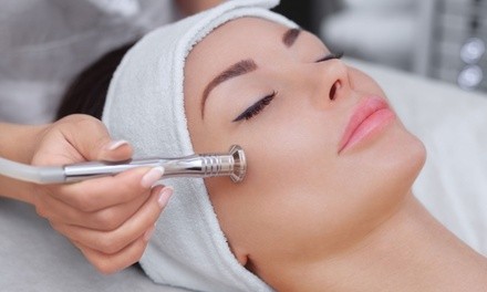 One Diamond Microdermabrasion Treatment with Optional Chemical Peel at Esthetics by Jenna (Up to 51% Off)