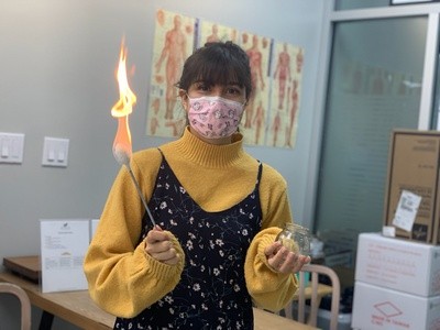 Up to 35% Off on Cupping at Santa Clara acupuncture