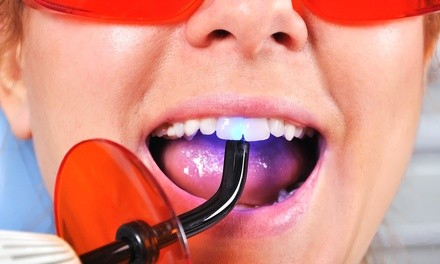 One 30- or 60-Minute In-Office Teeth-Whitening Treatment at GetSculptedBy Lori (Up to 30% Off)