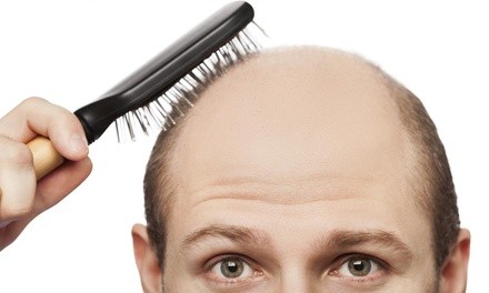 $248 Off $450 Worth of Hair Restoration - One 80 Medispa Wellness Center