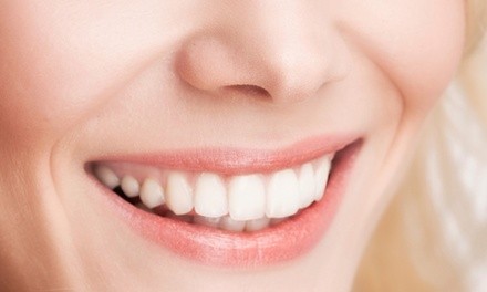 One or Two 60-Minute DaVinci Laser Teeth-Whitening Sessions at InfraRayZ (Up to 59% Off)