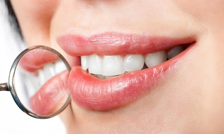 Up to 59% Off on Teeth Whitening - In-Office - Non-Branded at Enhance Yourself Beauty