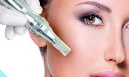 Up to 54% Off on Micro-Needling at Angel M. Brant, Aesthetics