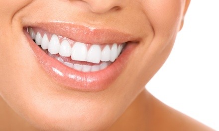 Dental Exam, Cleaning, and X-ray with Optional Zoom! Whitening Treatment at Nazanin Ezzati DDS (Up to 88% Off)