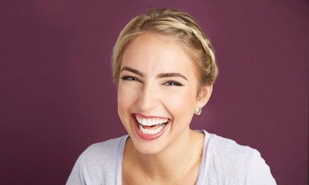 Up to 60% Off on Teeth Whitening - Traditional at Le' Bar Beaute'