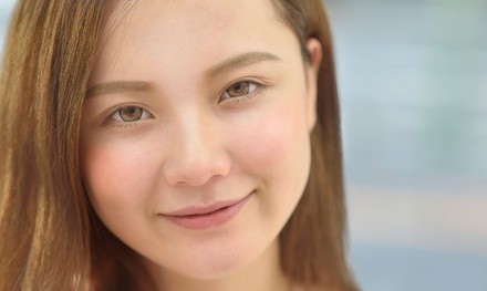 One, Two, or Four IPL Photofacials at Slim Beauty Center (Up to 83% Off)